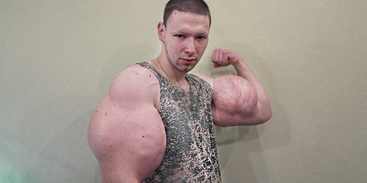O ‘Popeye Russo’ que corre risco de morte por causa do abuso de Synthol